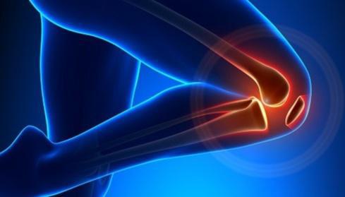 Total Knee Replacement