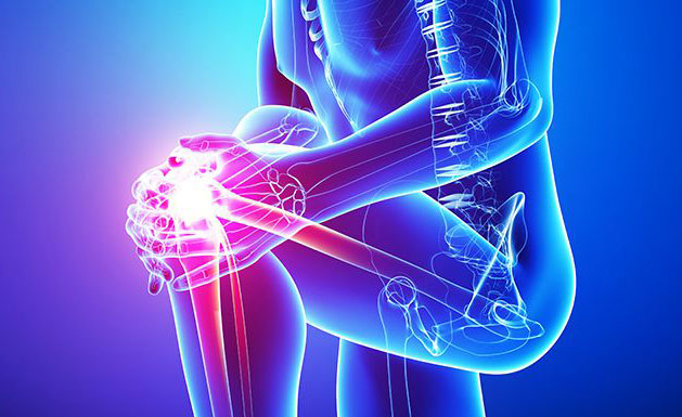 Total Knee Replacement